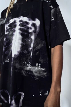 Radiation T-Shirt -JADEDLDN Sales RIBCAGETSHIRT5